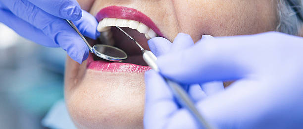Best Walk-In Emergency Dental Services in Rotonda, FL